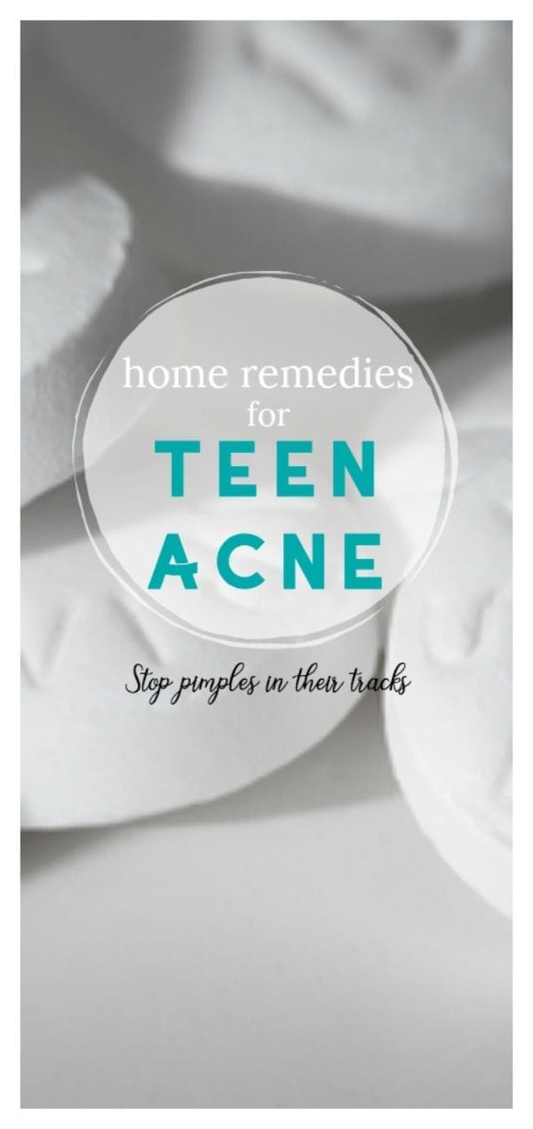 5 Home Remedies for Teen Acne | Natural treatment for oily skin and pimples | TodaysCreativeLife.com